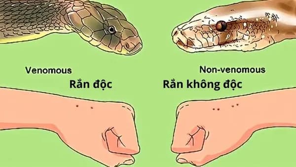 Hình ảnh dấu rắn cắn.